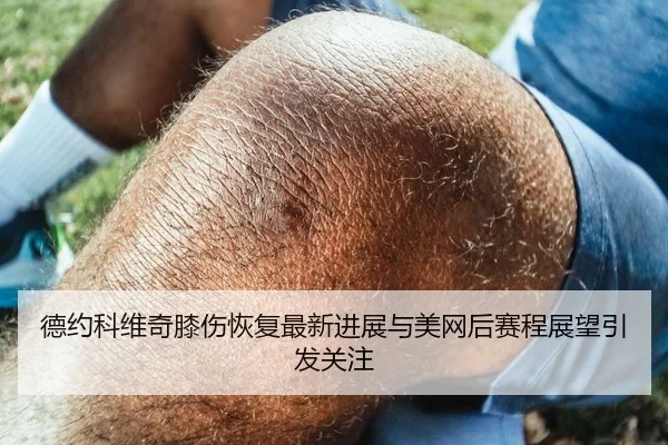 德约科维奇膝伤恢复最新进展与美网后赛程展望引发关注